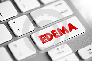 Edema is swelling caused by excess fluid trapped in your body\'s tissues, text concept button on keyboard photo