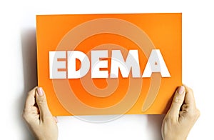 Edema is swelling caused by excess fluid trapped in your body\'s tissues, text concept on card for presentations and reports photo