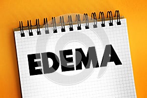 Edema is swelling caused by excess fluid trapped in your body\'s tissues, text on notepad