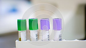 EDTA purple test tube compleate blood count test and lithium heparin green test tube for blood chemistry test