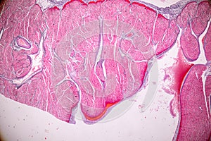 Histological sample Heart muscle Tissue under the microscope.