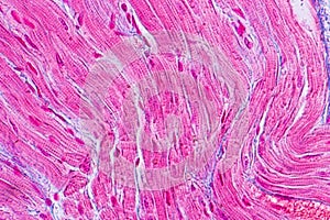 Histological sample Heart muscle Tissue under the microscope.