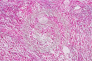 Histological sample Ovary of rabbit Tissue under the microscope.