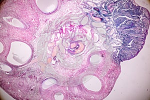 Histological sample Ovary of rabbit Tissue under the microscope.