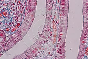 Histological sample Simple columnar epithelium Tissue under the microscope. photo