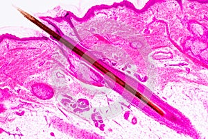 Education anatomy and physiology of Human scalp show of hair folticles under the microscopic.