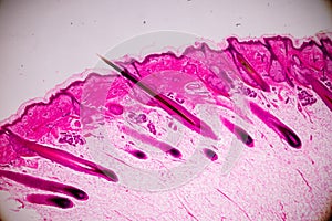 Education anatomy and physiology of Human scalp show of hair folticles under the microscopic.