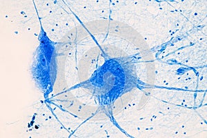 Motor Neuron under the microscope.