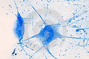 Motor Neuron under the microscope. photo