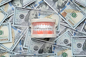 Educational dental typodont model on heap of dollar banknotes, top view. Expensive treatment