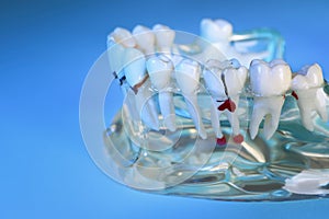 Educational dental typodont model with teeth on light blue background, closeup