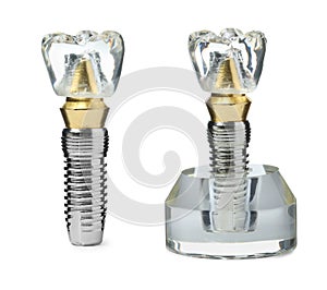 Educational models of dental implants on white background, collage