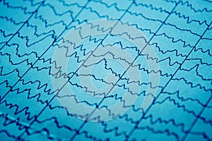 EEG electro physiological monitoring metod. Electrical activity of the brain.