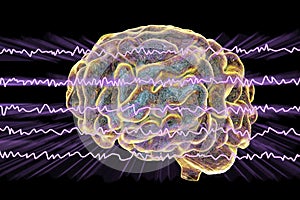 EEG Electroencephalogram, brain wave in awake state with mental activity