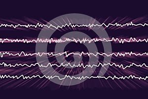 EEG Electroencephalogram, brain wave in awake state with mental activity