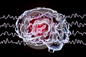 EEG Electroencephalogram, brain wave in awake state during rest