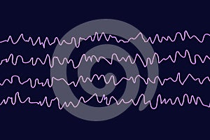 EEG Electroencephalogram, brain wave in awake state during rest