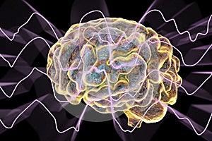 EEG Electroencephalogram, brain wave in deep sleep