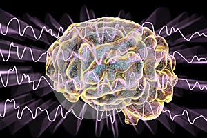 EEG Electroencephalogram, brain wave during sleeping