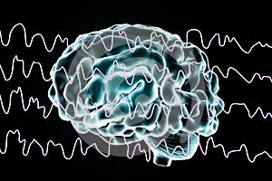 EEG Electroencephalogram, brain wave during sleeping