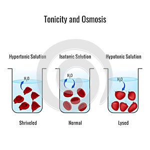 Effects of hypertonic, hypotonic and istonic solutions to red blood cells