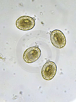 Egg of Ascaris lumbricoides