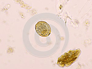 Egg of Ascaris lumbricoides (roundworm)