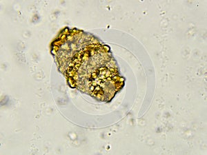Egg of Ascaris lumbricoides (roundworm)