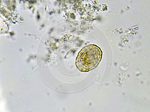 Egg of Ascaris lumbricoides roundworm