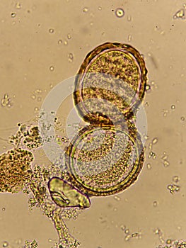 Egg of Ascaris lumbricoides roundworm in human stool