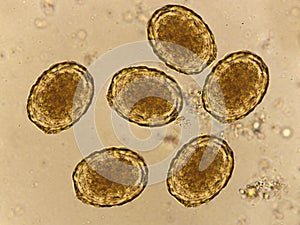 Egg of Ascaris lumbricoides roundworm in human stool