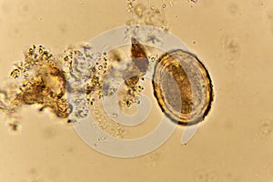 Egg of Ascaris lumbricoides roundworm in human stool