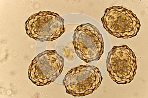 Egg of Ascaris lumbricoides roundworm in human stool