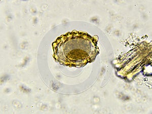 Egg of Ascaris lumbricoides (roundworm)