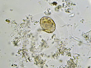 Egg of Ascaris lumbricoides roundworm photo