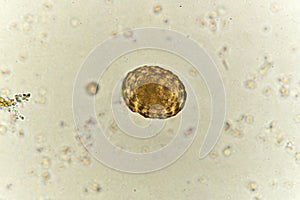 Egg of Ascaris lumbricoides in stool