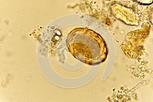 Egg of Ascaris lumbricoides photo