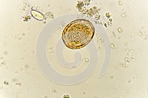 Egg of Ascaris lumbricoides in stool photo