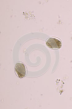 Egg of Hookworm in human stool