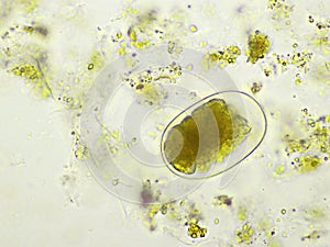 Egg of Hookworm in human stool