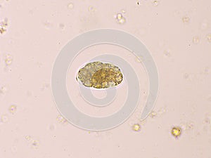 Egg of Hookworm in human stool