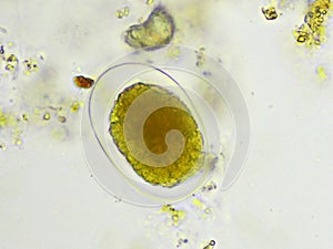 Egg of Hookworm in human stool