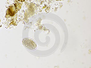 Egg of Hookworm in human stool
