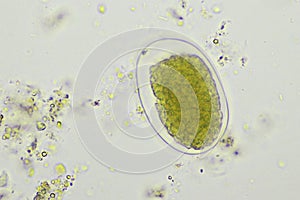 Egg of Hookworm in human stool