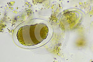 Egg of Hookworm in human stool