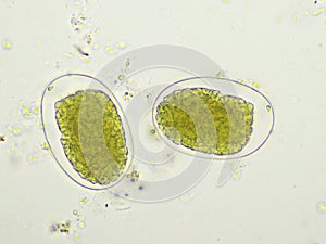 Egg of Hookworm in human stool