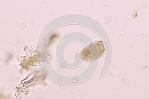 Egg of Hookworm in human stool