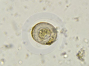 Egg of Hymenolepis
