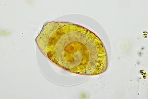 Egg of intestinal fluke in human stool