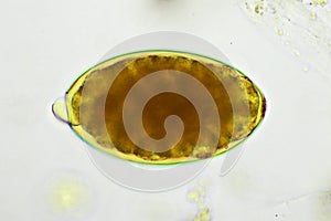 Egg of intestinal fluke in human stool